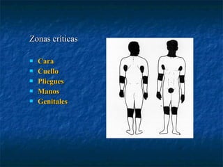 Zonas críticasZonas críticas
 CaraCara
 CuelloCuello
 PlieguesPliegues
 ManosManos
 GenitalesGenitales
 