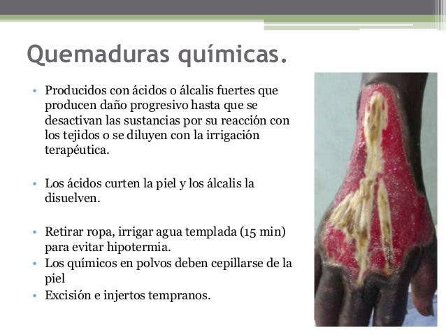 Acido Clorhidrico Efectos En La Piel