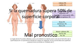 La regla de los 9 puede utilizarse como una referencia rápida para calcular el tamaño de la
quemadura en un paciente al dividir el cuerpo en regiones, en la cual el área de superficie
corporal total se divide en múltiplos de 9.
Si la quemadura supera 50% de
superficie corporal
Mal pronostico
 