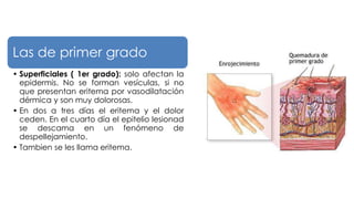 Las de primer grado
• Superficiales ( 1er grado): solo afectan la
epidermis. No se forman vesículas, si no
que presentan eritema por vasodilatación
dérmica y son muy dolorosas.
• En dos a tres días el eritema y el dolor
ceden. En el cuarto día el epitelio lesionad
se descama en un fenómeno de
despellejamiento.
• Tambien se les llama eritema.
 
