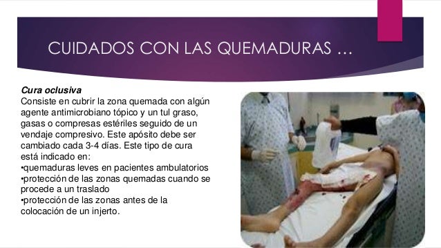 Cuidados De Enfermeria En Quemaduras Slideshare