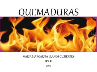 QUEMADURAS
MARIA MARGARITA LLANOS GUTIERREZ
USCO
2015
 