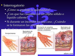 • InterrogatorioInterrogatorio
• ¿Cómo se produjo la quemadura?¿Cómo se produjo la quemadura?
• ¿Con que fue causada con un objeto sólido o¿Con que fue causada con un objeto sólido o
liquido caliente?liquido caliente?
• Si durante un incendio en una casa ; ¿CuándoSi durante un incendio en una casa ; ¿Cuándo
se le formaron las ampollas?se le formaron las ampollas?
• ¿Si algún momento estuvo inconciente?¿cuanto¿Si algún momento estuvo inconciente?¿cuanto
tiempo?tiempo?
 