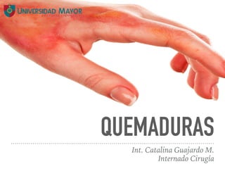 QUEMADURAS
Int. Catalina Guajardo M.
Internado Cirugía
 