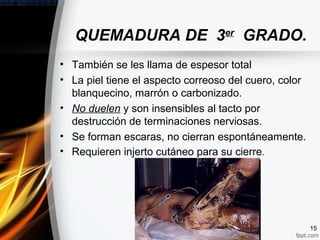 QUEMADURA DE 3er
GRADO.
• También se les llama de espesor total
• La piel tiene el aspecto correoso del cuero, color
blanquecino, marrón o carbonizado.
• No duelen y son insensibles al tacto por
destrucción de terminaciones nerviosas.
• Se forman escaras, no cierran espontáneamente.
• Requieren injerto cutáneo para su cierre.
15
 