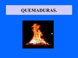 QUEMADURAS. 