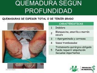 QUEMADURA SEGÚN
PROFUNDIDAD
CARACTERISTICAS
1 Indolora
2
Blanquecina, amarilla o marrón
oscuro
3 > Apergaminada y correosa
4 Vasos trombosados
5
Tratamiento quirúrgico obligado
Puede requerir amputación
Secuelas importantes
20/03/2020 15
QUEMADURAS DE ESPESOR TOTAL O DE TERCER GRADO
 