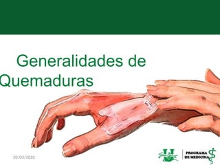 Generalidades de
Quemaduras Temática
20/03/2020 3
 