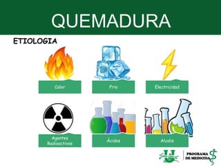 QUEMADURA
5
ETIOLOGIA
Calor Frio Electricidad
Agentes
Radioactivos
Ácidos Alcalis
 