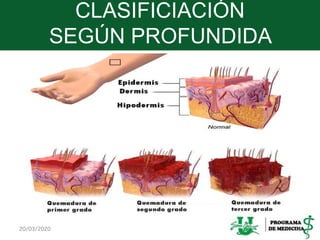 CLASIFICIACIÓN
SEGÚN PROFUNDIDA
20/03/2020 6
 