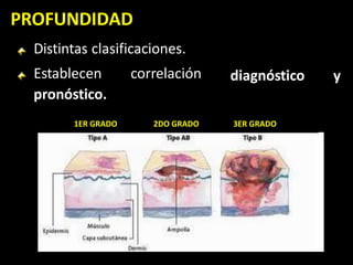 PROFUNDIDAD
diagnóstico y
Distintas clasificaciones.
Establecen correlación
pronóstico.
1ER GRADO 2DO GRADO 3ER GRADO
 