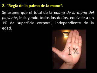 2. “Regla de la palma de la mano”.
Se asume que el total de la palma de la mano del
paciente, incluyendo todos los dedos, equivale a un
1% de superficie corporal, independiente de la
edad.
 