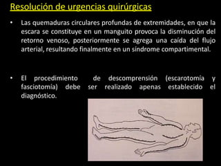 Resolución de urgencias quirúrgicas
• Las quemaduras circulares profundas de extremidades, en que la
escara se constituye en un manguito provoca la disminución del
retorno venoso, posteriormente se agrega una caída del flujo
arterial, resultando finalmente en un síndrome compartimental.
• El procedimiento de descomprensión (escarotomía y
fasciotomía) debe ser realizado apenas establecido el
diagnóstico.
 