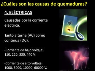 ¿Cuáles son las causas de quemaduras?
4. ELÉCTRICAS
Causadas por la corriente
eléctrica.
Tanto alterna (AC) como
continua (DC).
-Corriente de bajo voltaje:
110, 220, 330, 440 V.
-Corriente de alto voltaje:
1000, 5000, 10000, 60000 V.
 