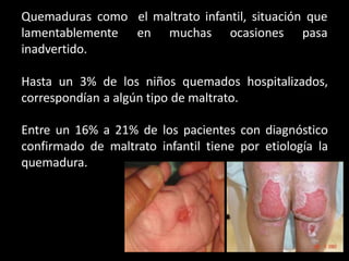 el maltrato infantil, situación que
en muchas ocasiones pasa
Quemaduras como
lamentablemente
inadvertido.
Hasta un 3% de los niños quemados hospitalizados,
correspondían a algún tipo de maltrato.
Entre un 16% a 21% de los pacientes con diagnóstico
confirmado de maltrato infantil tiene por etiología la
quemadura.
 