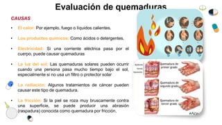 Evaluación de quemaduras
• El calor: Por ejemplo, fuego o líquidos calientes.
• Los productos químicos: Como ácidos o detergentes.
• Electricidad: Si una corriente eléctrica pasa por el
cuerpo, puede causar quemaduras
• La luz del sol: Las quemaduras solares pueden ocurrir
cuando una persona pasa mucho tiempo bajo el sol,
especialmente si no usa un filtro o protector solar
• La radiación: Algunos tratamientos de cáncer pueden
causar este tipo de quemadura.
• La fricción: Si la piel se roza muy bruscamente contra
una superficie, se puede producir una abrasión
(raspadura) conocida como quemadura por fricción.
CAUSAS
 