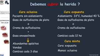 QUEMADURAS .pdf