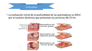 • La evaluación inicial de la profundidad de las quemaduras es difícil
por el carácter dinámico que presentan las primeras 48-72 hrs
Profundidad
 