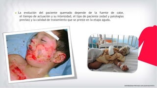▶ La evolución del paciente quemado depende de la fuente de calor,
el tiempo de actuación y su intensidad, el tipo de paciente (edad y patologías
previas) y la calidad de tratamiento que se preste en la etapa aguda.
 