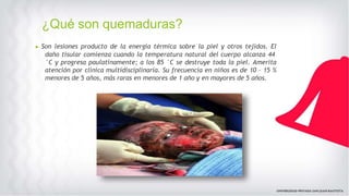 ¿Qué son quemaduras?
▶ Son lesiones producto de la energía térmica sobre la piel y otros tejidos. El
daño tisular comienza cuando la temperatura natural del cuerpo alcanza 44
°C y progresa paulatinamente; a los 85 °C se destruye toda la piel. Amerita
atención por clínica multidisciplinaria. Su frecuencia en niños es de 10 – 15 %
menores de 5 años, más raras en menores de 1 año y en mayores de 5 años.
 