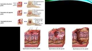 Comprehensive Overview of Burn Injuries: Classification, Assessment ...