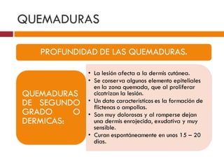 QUEMADURAS 
