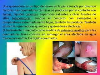 Una quemadura es un tipo de lesión en la piel causada por diversos
factores. Las quemaduras térmicas se producen por el contacto con
llamas, líquidos calientes, superficies calientes y otras fuentes de
altas temperaturas; aunque el contacto con elementos a
temperaturas extremadamente bajas, también las produce. También
existen las quemaduras químicas y quemaduras eléctricas.
El tratamiento inmediato como medida de primeros auxilios para las
quemaduras leves consiste en sumergir el área afectada en agua
fresca para enfriar los tejidos quemados.
 