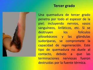 Tercer grado

Una quemadura de tercer grado
penetra por todo el espesor de la
piel; incluyendo nervios, vasos
sanguíneos, linfáticos, etc. Si se
destruyen         los       folículos
pilosebáceos y las glándulas
sudoríparas, se compromete la
capacidad de regeneración. Este
tipo de quemadura no duele al
contacto, debido a que las
terminaciones nerviosas fueron
destruidas por la fuente térmica.
 