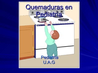 Pediatría U.A.G Quemaduras en  Pediatría  