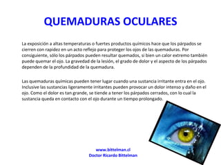 QUEMADURAS OCULARES ,[object Object],[object Object],www.bittelman.cl Doctor Ricardo Bittelman 