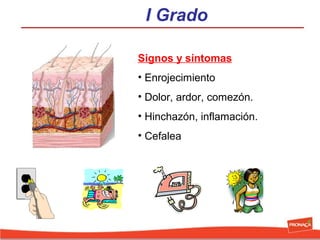 I Grado
Signos y síntomas
• Enrojecimiento
• Dolor, ardor, comezón.
• Hinchazón, inflamación.
• Cefalea

 