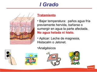 I Grado
Tratamiento
• Bajar temperatura: paños agua fría
previamente hervida, bañarse o
sumergir en agua la parte afectada.
No agua helada ni hielo.
• Aplicar: Leche de magnesia,
Histacalm o Jelonet.
•Analgésicos

 