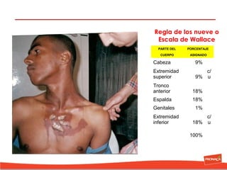 Regla de los nueve o
Escala de Wallace
PARTE DEL

PORCENTAJE

CUERPO

ASIGNADO

Cabeza

9%

 

Extremidad 
superior

c/
9% u

Tronco 
anterior

18%

 

Espalda

18%

 

Genitales

1%

 

Extremidad 
inferior

c/
18% u
100%

 