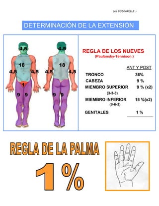 quemaduras2-111014074228-phpapp02.pdf