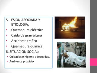 5. LESION ASOCIADA Y
    ETIOLOGIA:
• Quemadura eléctrica
• Caída de gran altura
• Accidente trafico
• Quemadura química
6. SITUACION SOCIAL:
• Cuidados e higiene adecuadas.
• Ambiente propicio
 