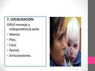 7. LOCALIZACION:
Difícil manejo y
  independencia pcte.
• Manos.
• Pies.
• Cara.
• Periné.
• Articulaciones.
 