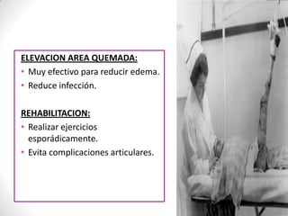 ELEVACION AREA QUEMADA:
• Muy efectivo para reducir edema.
• Reduce infección.

REHABILITACION:
• Realizar ejercicios
  esporádicamente.
• Evita complicaciones articulares.
 