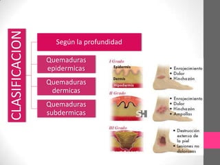 CLASIFICACION
                  Según la profundidad

                Quemaduras
                epidermicas
                Quemaduras
                 dermicas
                Quemaduras
                subdermicas
 