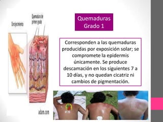 Quemaduras
         Grado 1

  Corresponden a las quemaduras
producidas por exposición solar; se
     compromete la epidermis
      únicamente. Se produce
 descamación en los siguientes 7 a
   10 días, y no quedan cicatriz ni
     cambios de pigmentación.
 