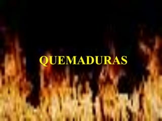 QUEMADURAS
 