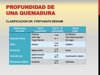 PROFUNDIDAD DE
UNA QUEMADURA
CLASIFICACION DR. FORTUNATO BENAIM
 
