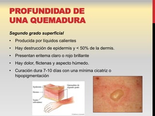 PROFUNDIDAD DE
UNA QUEMADURA
Segundo grado superficial
• Producida por líquidos calientes
• Hay destrucción de epidermis y < 50% de la dermis.
• Presentan eritema claro o rojo brillante
• Hay dolor, flictenas y aspecto húmedo.
• Curación dura 7-10 días con una mínima cicatriz o
  hipopigmentación
 