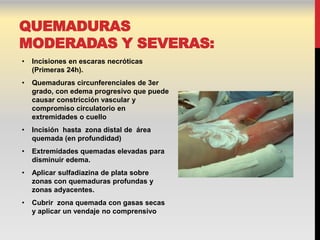 QUEMADURAS
MODERADAS Y SEVERAS:
•   Incisiones en escaras necróticas
    (Primeras 24h).
•   Quemaduras circunferenciales de 3er
    grado, con edema progresivo que puede
    causar constricción vascular y
    compromiso circulatorio en
    extremidades o cuello
•   Incisión hasta zona distal de área
    quemada (en profundidad)
•   Extremidades quemadas elevadas para
    disminuir edema.
•   Aplicar sulfadiazina de plata sobre
    zonas con quemaduras profundas y
    zonas adyacentes.
•   Cubrir zona quemada con gasas secas
    y aplicar un vendaje no comprensivo
 
