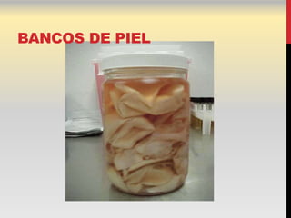 BANCOS DE PIEL
 