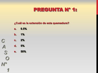 PREGUNTA N° 1:

      ¿Cuál es la extensión de esta quemadura?

      a.   0.5%

      b.   1%

C     c.   2%

      d.   5%
A
      e.   50%
 S
  O
N°
  1
 