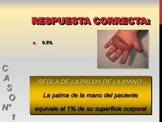 RESPUESTA CORRECTA:

      a.    0.5%




C
A          REGLA DE LA PALMA DE LA MANO:
 S
  O         La palma de la mano del paciente
N°     equivale al 1% de su superficie corporal
  1
 