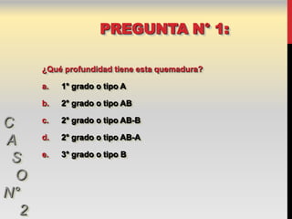 PREGUNTA N° 1:

      ¿Qué profundidad tiene esta quemadura?

      a.   1° grado o tipo A

      b.   2° grado o tipo AB

C     c.   2° grado o tipo AB-B

      d.   2° grado o tipo AB-A
A
      e.   3° grado o tipo B
 S
  O
N°
  2
 