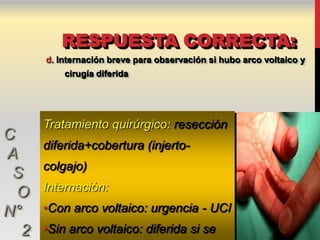 RESPUESTA CORRECTA:
      d. Internación breve para observación si hubo arco voltaico y
          cirugía diferida




      Tratamiento quirúrgico: resección
C
      diferida+cobertura (injerto-
A
      colgajo)
 S
  O   Internación:

N°    •Con arco voltaico: urgencia - UCI
  2   •Sin arco voltaico: diferida si se
 