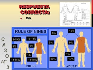 RESPUESTA
            CORRECTA:
               e.   19%



                                     18%
                               9%

C      9-19%        13-18%
                              9%     9%
A      9%             9%

 S
                    1%              1%
  O                           18%    18%
      13-18%         13-18%
N°
  3
 