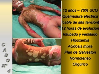 12 años – 70% SCQ
       Quemadura eléctrica
       (cable de alta tensión)
       12 horas de evolución
        Intubado y ventilado
            Hipoxemia
C          Acidosis mixta
A       Plan de Galveston
 S
            Normotenso
  O
N°           Oligúrico
   4
 